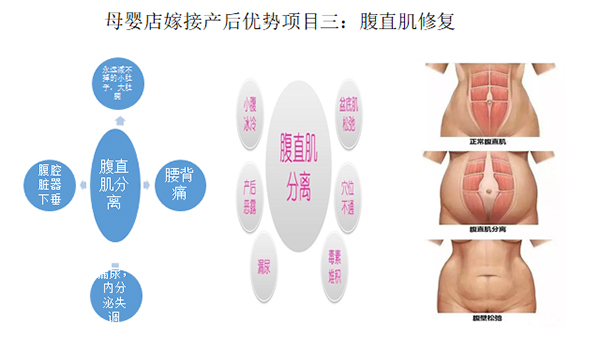 少林永化堂產(chǎn)后項(xiàng)目-腹直肌修復(fù)