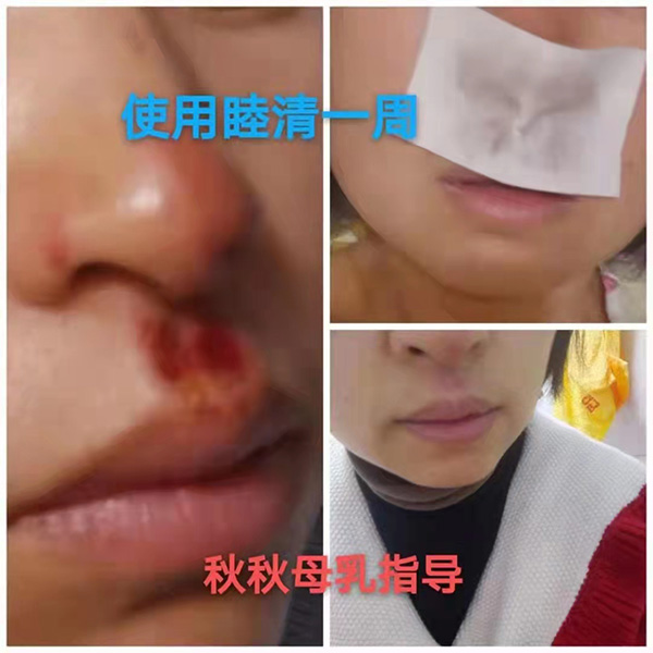 �����澏���N���Æ������M(f��i)�߿ڱ���������(sh��)���a(ch��n)ƷȦ�۟o��(sh��)